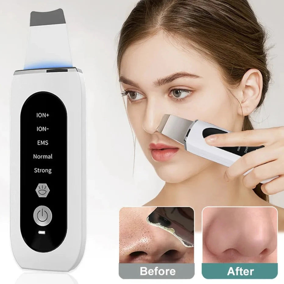 Ultrasonic Skin Scrubber Peeling