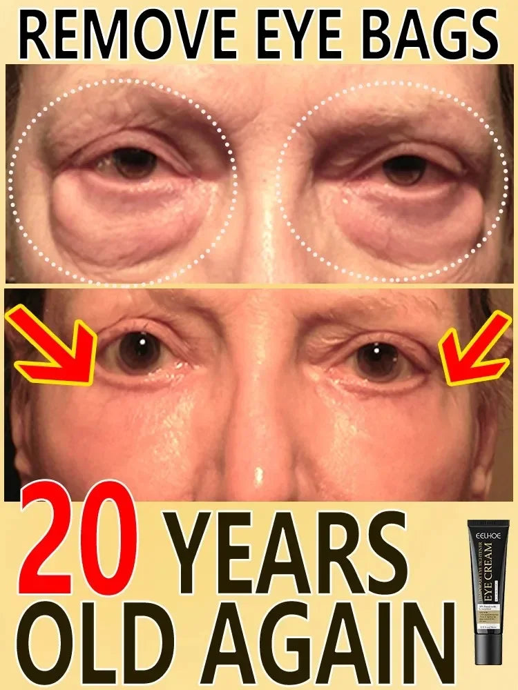 Wrinkles Eye Cream